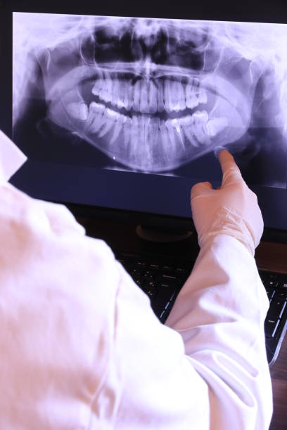 Best Emergency Root Canal Treatment in Wynnewood, OK